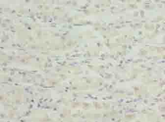 TSPAN33 Polyclonal Antibody