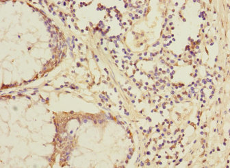 NIT1 Polyclonal Antibody