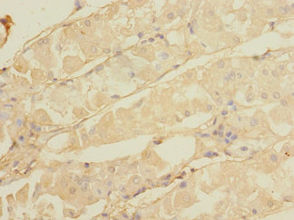 CALHM3 Polyclonal Antibody