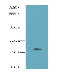 FAM122B Polyclonal Antibody