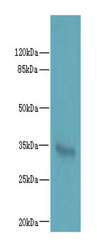 LYSMD3 Polyclonal Antibody