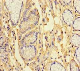 ANKRD33 Polyclonal Antibody