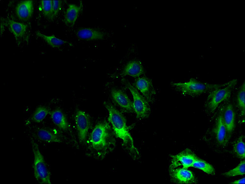 CYP2U1 Polyclonal Antibody