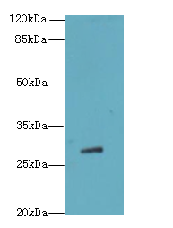TBC1D26 Polyclonal Antibody