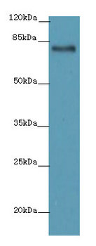 LCA5 Polyclonal Antibody