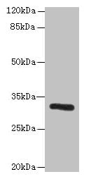 PPP1R3B Polyclonal Antibody