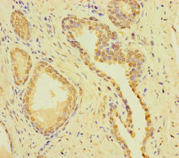 CSMD2 Polyclonal Antibody