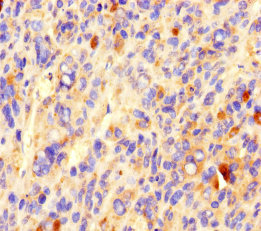 CCDC84 Polyclonal Antibody