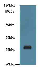 C17orf64 Polyclonal Antibody