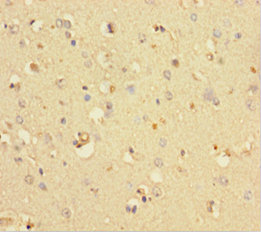 COMMD6 Polyclonal Antibody (100 µl)