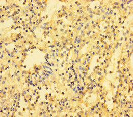 Immunohistochemistry of paraffin-embedded human spleen tissue using ABI3BP Polyclonal Antibody at dilution of 1:100