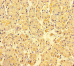 Immunohistochemistry of paraffin-embedded human pancreatic tissue using ABI3BP Polyclonal Antibody at dilution of 1:100