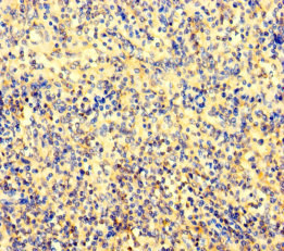 AMIGO1 Polyclonal Antibody