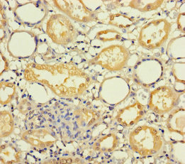 MRPL21 Polyclonal Antibody