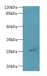 ARPIN Polyclonal Antibody