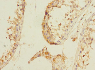 NPM2 Polyclonal Antibody