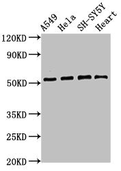 ATG4D Polyclonal Antibody (100 µl)