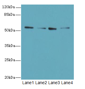 ERO1B Polyclonal Antibody