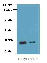 RD3 Polyclonal Antibody