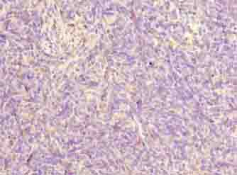 FAM124A Polyclonal Antibody