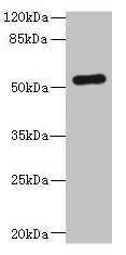 LDHD Polyclonal Antibody