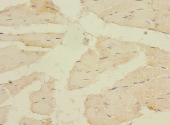 CACNA2D4 Polyclonal Antibody