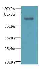 TTC30A Polyclonal Antibody