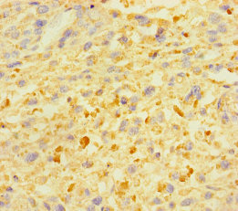 ZSCAN29 Polyclonal Antibody