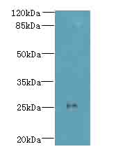 C11orf53 Polyclonal Antibody