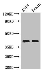 Septin 12 Polyclonal Antibody