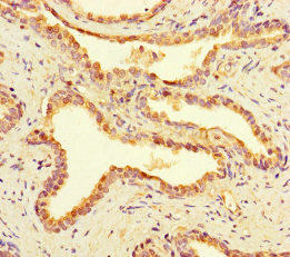 MINA Polyclonal Antibody