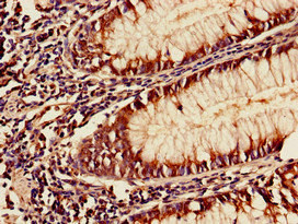YAF2 Polyclonal Antibody