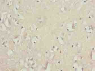 GLB1L2 Polyclonal Antibody