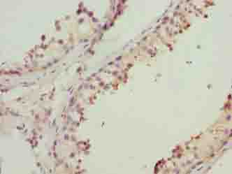 MRPL41 Polyclonal Antibody