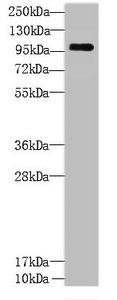 CCDC103 Polyclonal Antibody