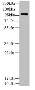 CCDC103 Polyclonal Antibody (100 µl)