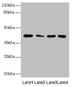CBWD2 Polyclonal Antibody (100 µl)