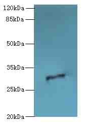 ODF3L1 Polyclonal Antibody