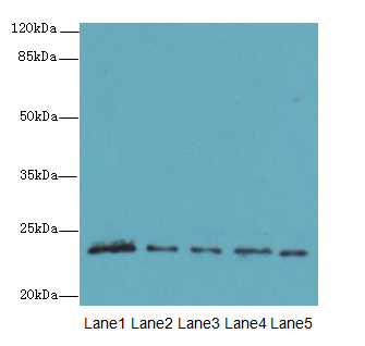 MMD2 Polyclonal Antibody