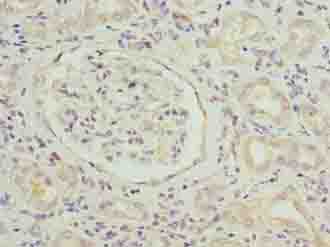 SLITRK4 Polyclonal Antibody