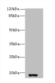 ZBTB8OS Polyclonal Antibody