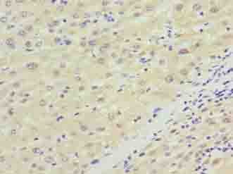 NKAIN4 Polyclonal Antibody