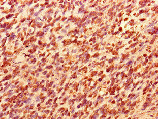 TCEAL8 Polyclonal Antibody