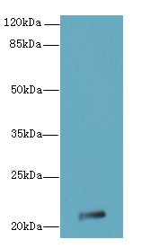 JAGN1 Polyclonal Antibody