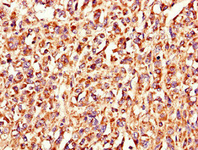 LSMEM1 Polyclonal Antibody