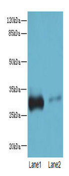 PI4KAP1 Polyclonal Antibody