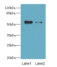 LACE1 Polyclonal Antibody
