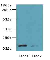 DYDC1 Polyclonal Antibody