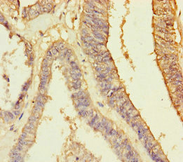 RBPMS Polyclonal Antibody