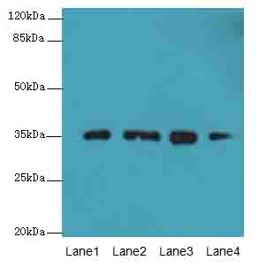 FAHD2A Polyclonal Antibody
